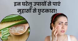 उमस और पसीने से चेहरे पर निकल रहे हैं मुंहासे? ये 5 घरेलू उपाय दिलाएंगे निजात