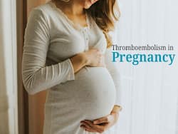 Thromboembolism in Pregnancy: Can Blood Clots During Pregnancy Cause a Miscarriage?