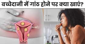 बच्चेदानी में गांठ होने पर इस तरह का रखें अपना डाइट, वरना बढ़ सकती है महिलाओं की समस्या बच्चेदानी में गांठ होने पर इस तरह का रखें अपना डाइट, वरना बढ़ सकती है महिलाओं की समस्या