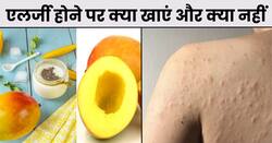 सीजन चेंज के साथ बढ़ जाती है खुजली और स्किन प्रॉब्लम्स, तो करें ये 5 उपाय, मिलेगा एलर्जी से छुटकारा
