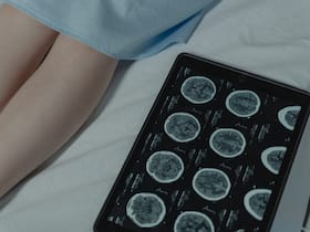 Epilepsy: A Hidden Complication Of Brain Tumors