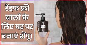 बाल गीले हो जाने पर बढ़ जाती है डैंड्रफ की परेशानी, इन 2 होममेड शैंपू से करें इसका इलाज