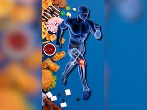 जोड़ों में दर्द है तो इन 8 चीजों का गलती से भी न करें सेवन