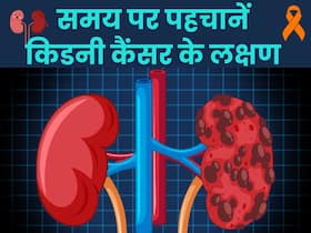 किडनी कैंसर होने से पहले शरीर में दिखते हैं ये 5 बदलाव, जानिए Kidney Cancer के शुरुआती लक्षण