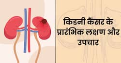 किडनी कैंसर: जानें इसके प्रारंभिक लक्षण और उपचार से जुड़ी कुछ अहम बातें