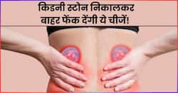 किडनी की पथरी को पेशाब के रास्ते निकाल देंगी ये 5 चीजें, असहनीय दर्द से मिलेगा तुरंत छुटकारा