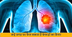 फेफड़ों में होने वाला कैंसर अक्सर फैल जाता शरीर में इन 5 जगहों पर अभी कर लें इनकी पहचान