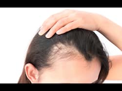 Can Vitamin D Deficiency Cause Female Hair Loss?