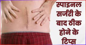 रीढ़ की हड्डी के ऑपरेशन के बाद जल्दी रिकवरी के लिए क्या करें? सीनियर डॉक्टर से जानिए
