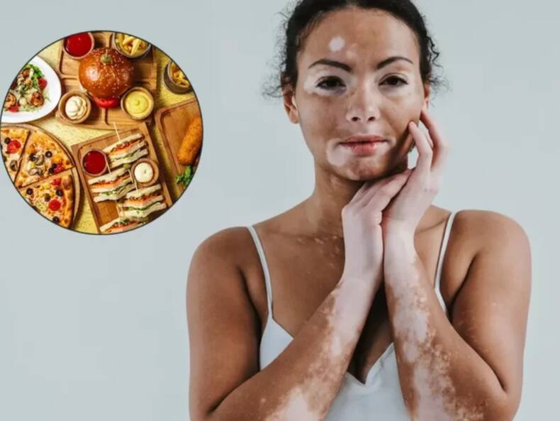 thehealthsite.com top news