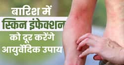 Monsoon Skin Infection: स्किन से जुड़ी परेशानी को दूर करेंगे ये आयुर्वेदिक उपाय