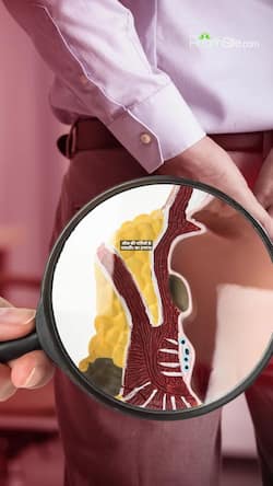 Piles treatment with neem leaf