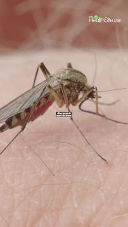 Zika Virus Symptoms Preventions