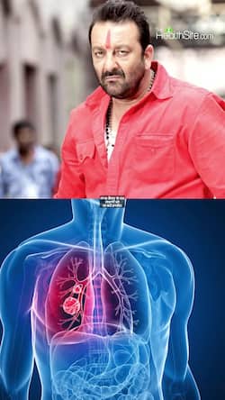 Sanjay Dutt Lungs Cancer survivor