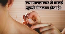 क्या एक्यूपंक्चर में वाकई सुइयों से इलाज होता है? जानिए इस दौरान कैसा महसूस होता है