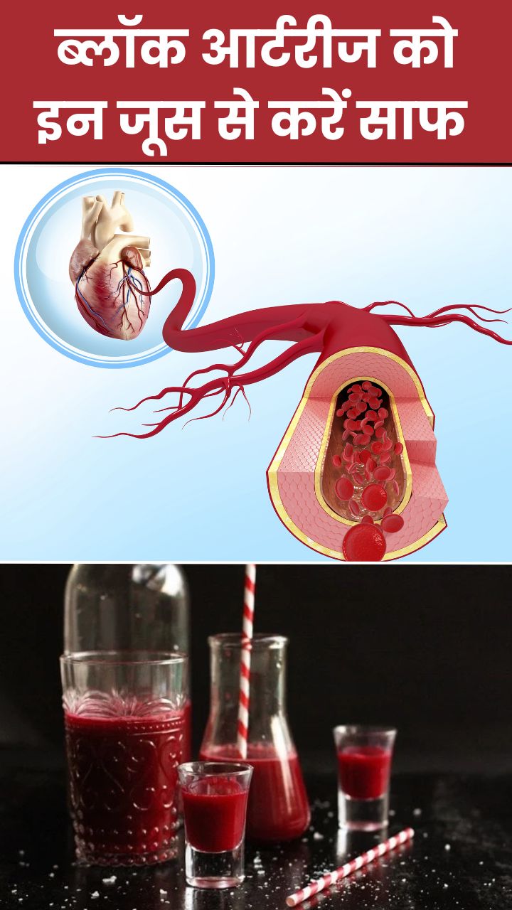 इन 7 जूस से आर्टरी पर जमे प्लाक को करें साफ
