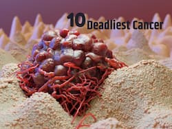 10 Deadliest Cancers In The World, And Their Warning Symptoms