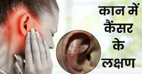कान में कैंसर की चेतावनी देता है ये सामान्य सा दिखने वाला लक्षण, 100 फीसदी लोग करते हैं इग्नोर