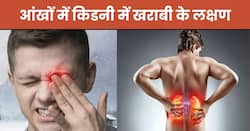 आंखों में इन 5 संकेतों से समझ जाएं पूरी तरह से सड़ चुकी है किडनी, 99 फीसदी लोग करते हैं इग्नोर