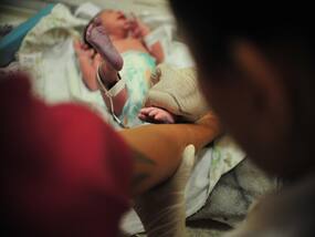 How Doctors Saved The Life Of A Baby Born Prematurely At 25 Weeks, Weighing Only A Few Grams