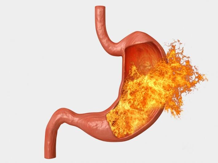 Are Persistent Nausea Or Vomiting Signs Of Stomach Cancer? Here Are 9 ...