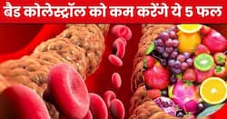 हाई कोलेस्ट्रॉल के दुश्मन हैं ये 5 देसी फल, नसों में जमा बैड कोलेस्ट्रॉल को खींचकर निकाल फेंकेंगे बाहर