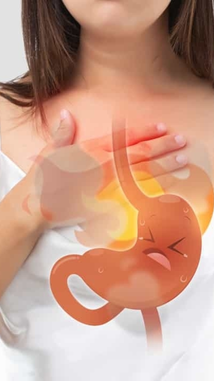 Seene mein jalan ka gharelu upay: एसिड रिफ्लक्स से राहत दिलाएंगे ये घरेलू उपाय