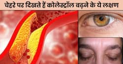 चेहरे पर दिखाई दें ये 5 लक्षण तो समझ जाएं बढ़ गया है बैड कोलेस्ट्रॉल, दिखते ही तुरंत कराएं टेस्ट