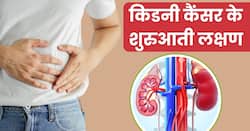 किडनी कैंसर के शुरुआती स्टेज में शरीर में नजर आते हैं ये 5 लक्षण, समय पर पहचानकर कराएं इलाज