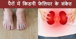 किडनी डैमेज होने से पहले पैरों में दिखते हैं ये 3 संकेत, ज्यादातर लोग मामूली सा समझकर करते हैं इग्नोर