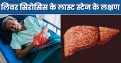 इन 3 संकेतों से समझ जाएं लास्ट स्टेज में पहुंच चुका है लिवर सिरोसिस, 99 फीसदी लोग करते हैं इग्नोर 