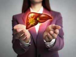 Can Hepatitis B And C Viruses Lead To Liver Cancer? Know It From The Expert