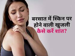 बारिश में भीगने के बाद स्किन पर हो रही है खुजली और फोड़े, नहाने के पानी में मिलाएं यह 1 चीज मिलेगा आराम