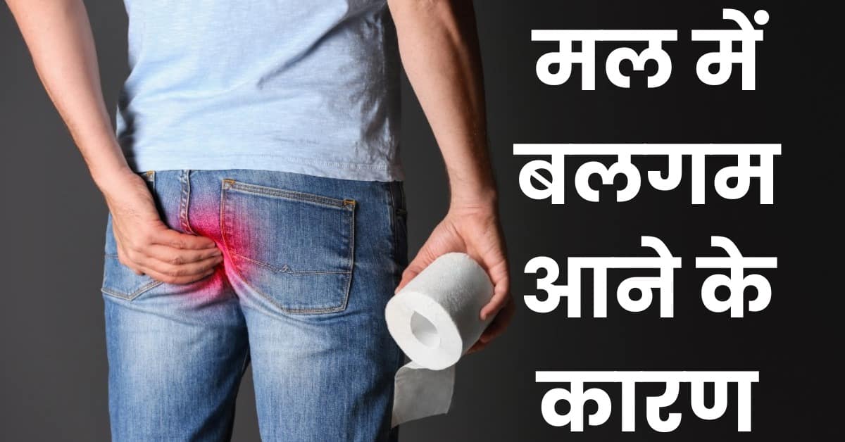 Mal me Safed Balgam Aane ka Karan मल में सफेद बलगम आने के पीछे हो