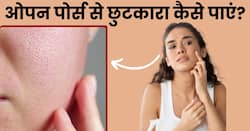 किन कारणों से स्किन पर ओपन पोर्स होते हैं? जानें Open Pores को कम करने के घरेलू उपाय