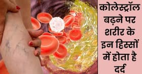 शरीर के इन 5 अंगों में दर्द को भूलकर भी न करें नजरअंदाज, हाई कोलेस्ट्रॉल का हो सकता है संकेत