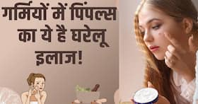 गर्मियों में पिम्पल्स से भर गया है चेहरा, ट्राई करें ये घरेलू उपाय