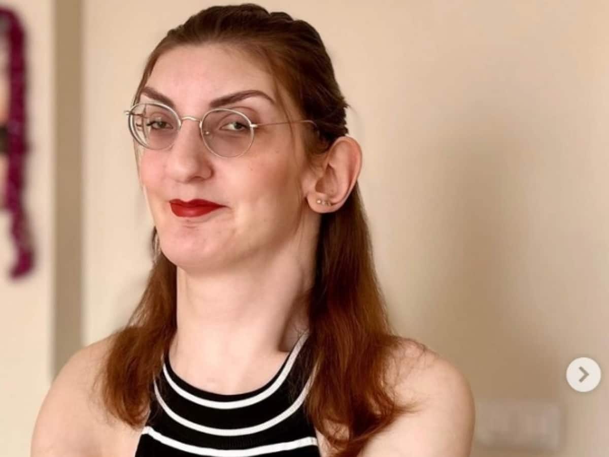 Guinness Recognition: Meet Rumeysa Gelgi, World’s Tallest Woman With The Longest Ears