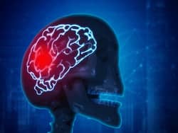 Stroke Risk: Can Genetic Factors, Ethnicity And Regional Disparities In Comorbidity Act As Contributing Factors?