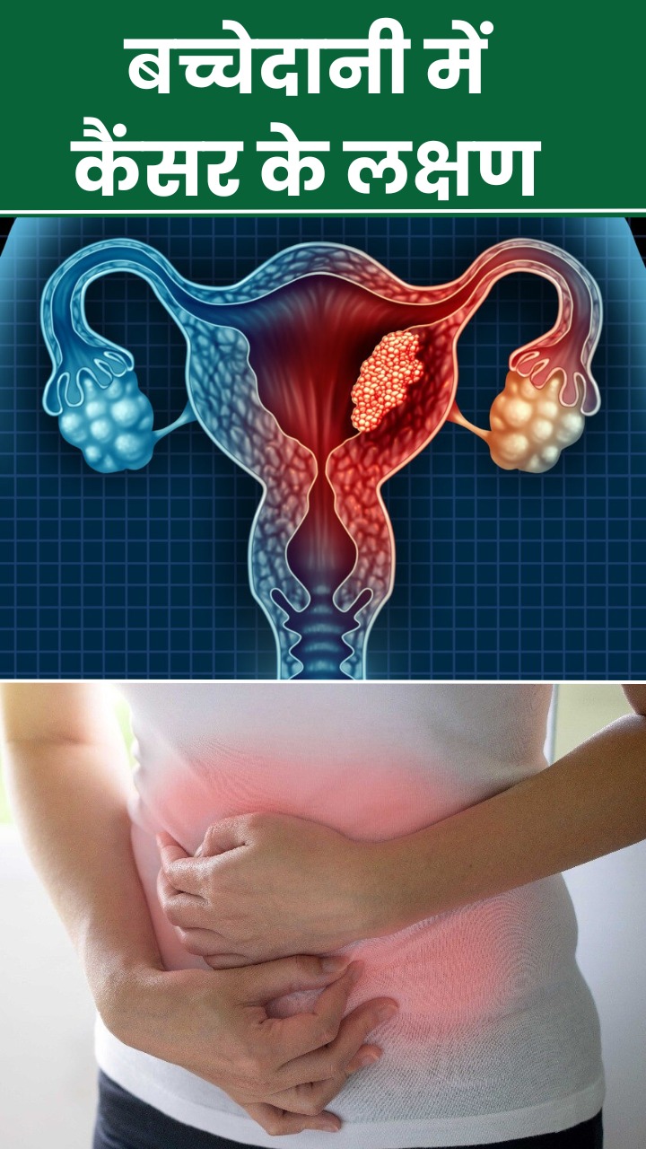 बच्चेदानी में कैंसर होने पर शरीर में दिखते हैं ये 8 लक्षण