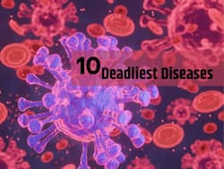 10 Deadliest Diseases In The World, And Their Warning Symptoms