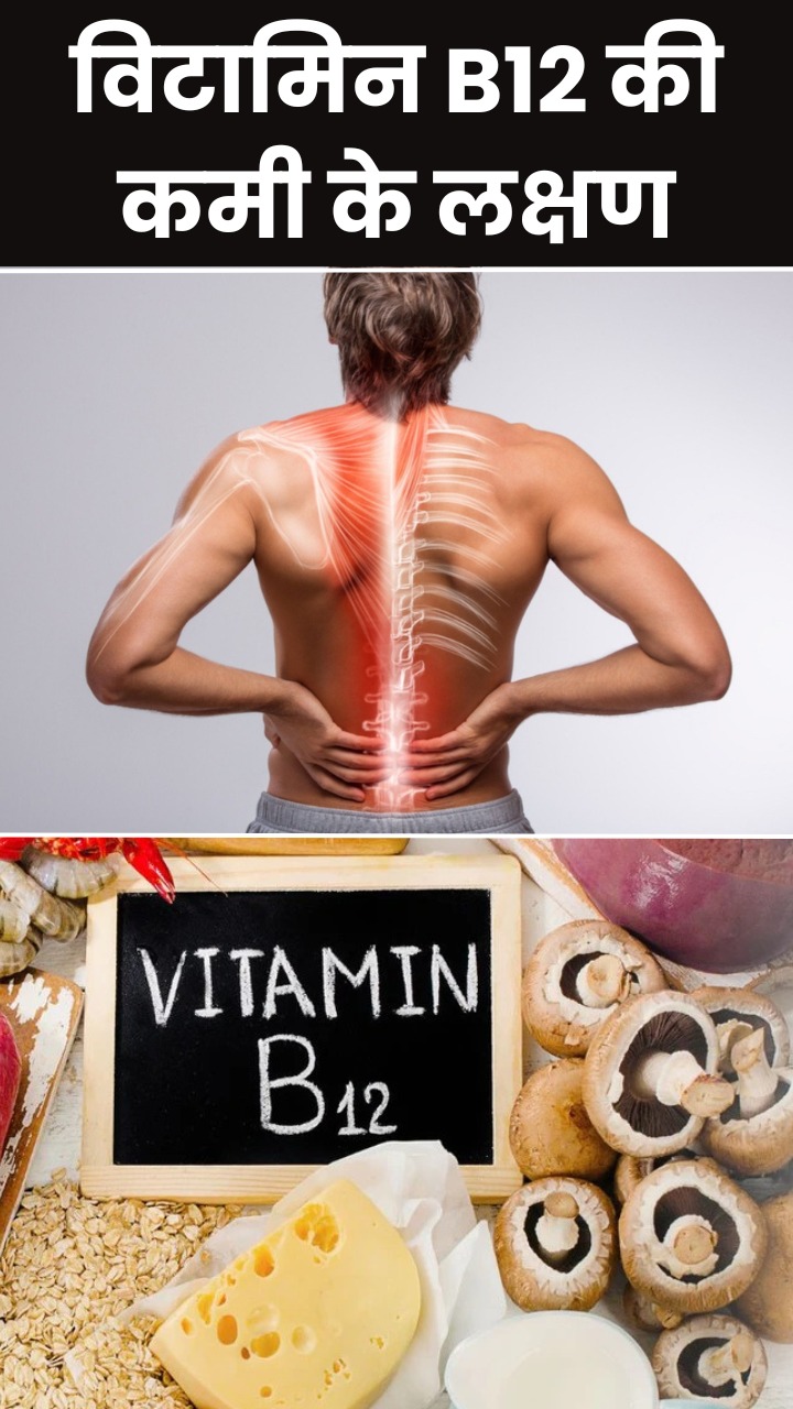 रात में दिखाई देते हैं विटामिन बी12 की कमी के ये 6 लक्षण
