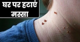 1 सप्ताह में जिद्दी मस्सा हटाने के लिए अपनाएं ये 5 नुस्खे, बिना सर्जरी हट जाएंगे दाग