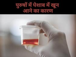 рдЗрди 9 рдХрд╛рд░рдгреЛрдВ рд╕реЗ рдкреБрд░реБрд╖реЛрдВ рдХреЗ рдкреЗрд╢рд╛рдм рдореЗрдВ рдЖрдиреЗ рд▓рдЧрддрд╛ рд╣реИ рдЦреВрди, рд▓рдХреНрд╖рдгреЛрдВ рдХреЛ рдкрд╣рдЪрд╛рдирдХрд░ рддреБрд░рдВрдд рдХрд░рд╛рдПрдВ рдЗрд▓рд╛рдЬ