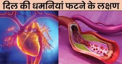 दिल की धमनी फटने पर शरीर देता है ये 5 संकेत, इग्नोर करना बढ़ा सकता है मौत का खतरा!