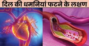 दिल की धमनी फटने पर शरीर देता है ये 5 संकेत, इग्नोर करना बढ़ा सकता है मौत का खतरा!