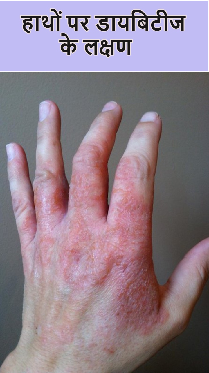 рд╣рд╛рдереЛрдВ рдХреЗ рдЗрди 7 рд╕рдВрдХреЗрддреЛрдВ рд╕реЗ рд╕рдордЭ рдЬрд╛рдПрдВ 400 рдХреЗ рдкрд╛рд░ рдкрд╣реБрдВрдЪ рдЪреБрдХрд╛ рд╣реИ рдмреНрд▓рдб рд╢реБрдЧрд░