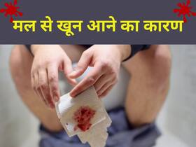 सुबह फ्रेश होने के दौरान मल से खून आना इन 7 बीमारियों के हैं संकेत, लक्षण पहचान कर तुरंत करें डॉक्टर से संपर्क सुबह फ्रेश होने के दौरान मल से खून आना इन 7 बीमारियों के हैं संकेत, लक्षण पहचान कर तुरंत करें डॉक्टर से संपर्क