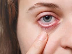 Eye Health: 5 Common Causes Of Sharp Pain In Eye