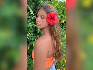 Hibiscus flowers for healthy hair: बालों के लिए गुड़हल के फूल के फायदे